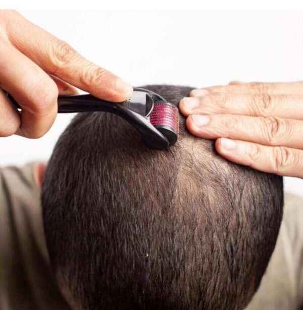 Derma Roller - Image 2